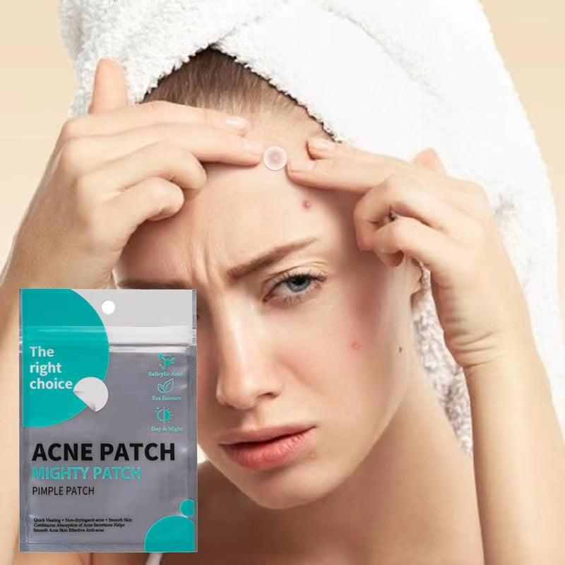 SolarMuse Hydrocolloid Pimple Patches – Fast-Acting Acne Spot Treatment